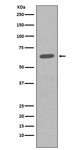 HDAC2 Rabbit mAb