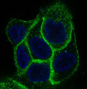EGFR Rabbit mAb