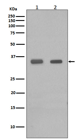 CEBP Beta Rabbit mAb