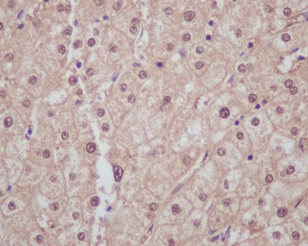 Liver Arginase Rabbit mAb