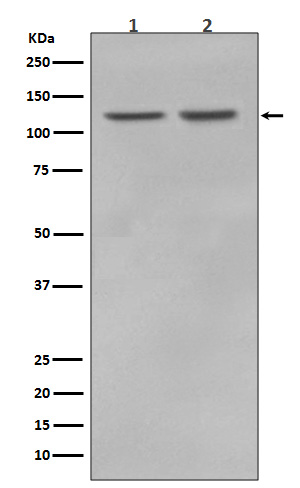 RNF20 Rabbit mAb