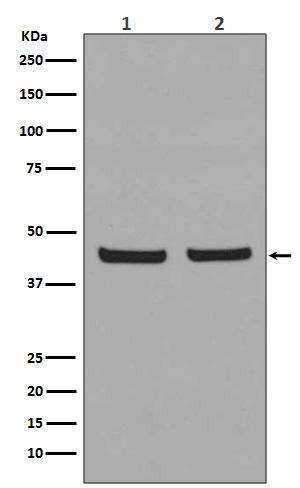 PHD1/prolyl hydroxylase Rabbit mAb