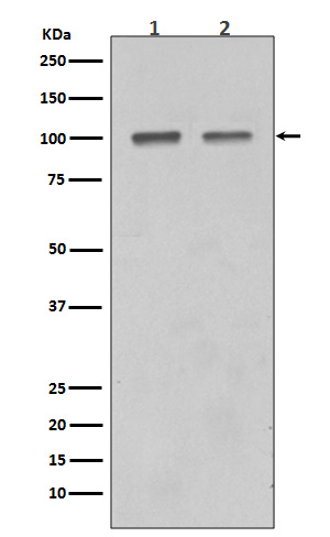 SATB1 Rabbit mAb