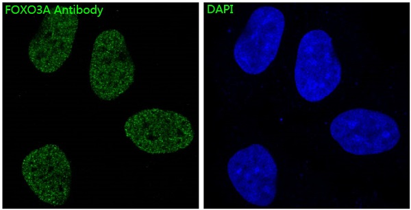 FoxO3a Rabbit mAb