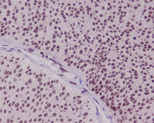 FoxO3a Rabbit mAb