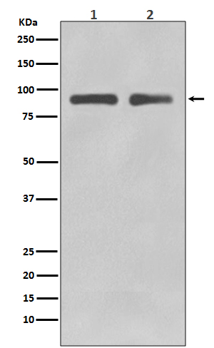 FoxO3a Rabbit mAb