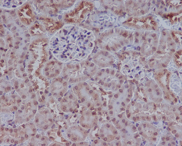 Rad51 Rabbit mAb