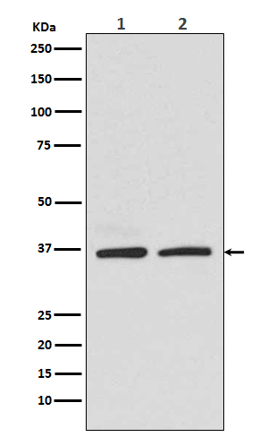 Rad51 Rabbit mAb