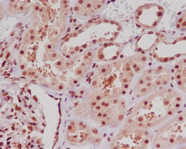 ERG Rabbit mAb