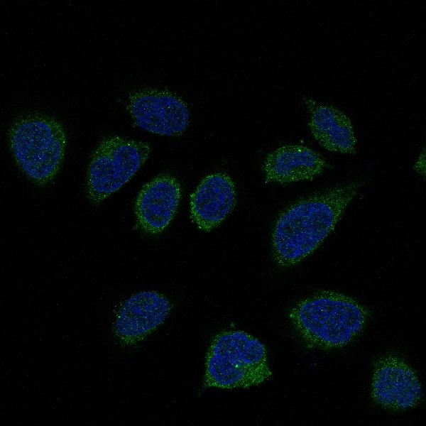 Smad2 Rabbit mAb