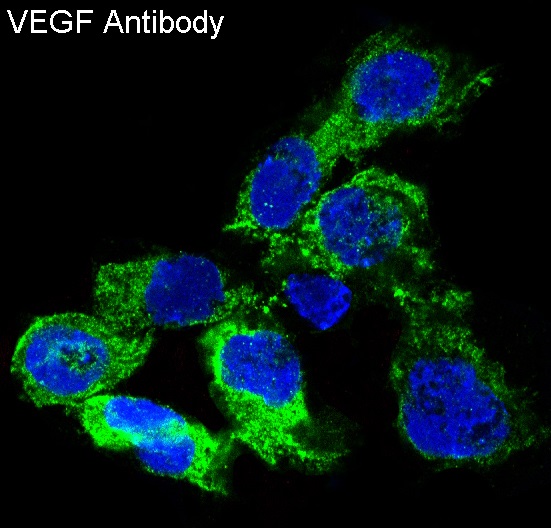 VEGF Rabbit mAb