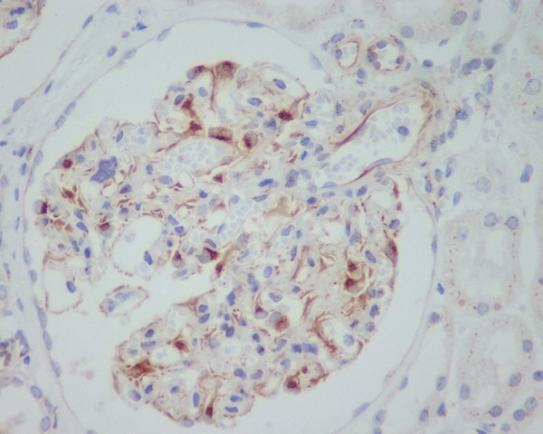 VEGF Rabbit mAb