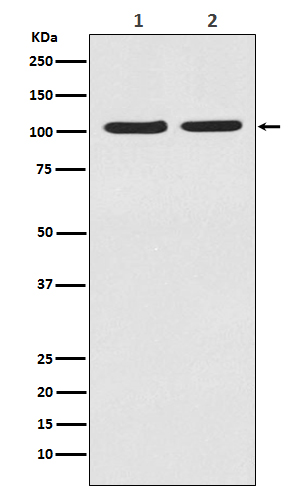 HIF-2 alpha Rabbit mAb