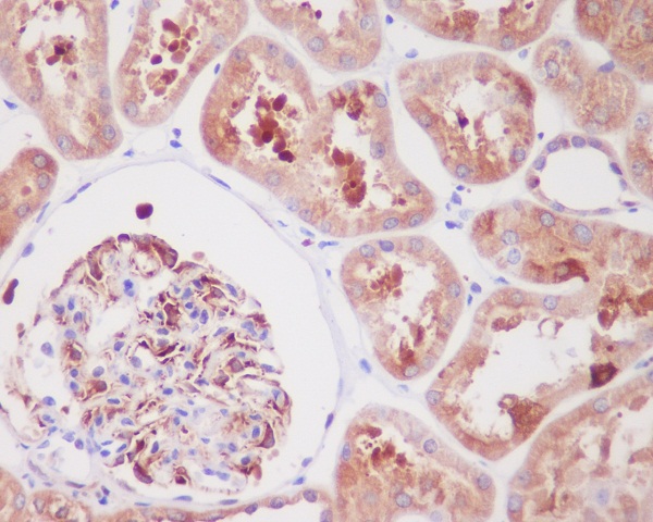 ARG1 Rabbit mAb