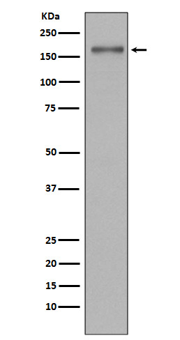 MSH6 Rabbit mAb