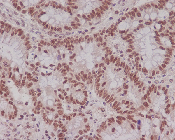 MLH1 Rabbit mAb