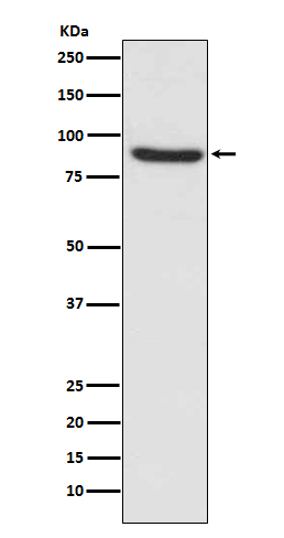 MLH1 Rabbit mAb