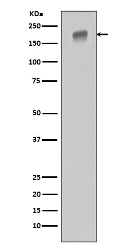 EGFR (ErbB 1) Rabbit mAb