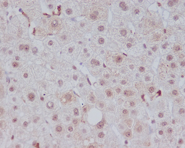 Heme Oxygenase 1 Rabbit mAb