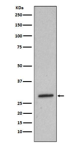 Heme Oxygenase 1 Rabbit mAb