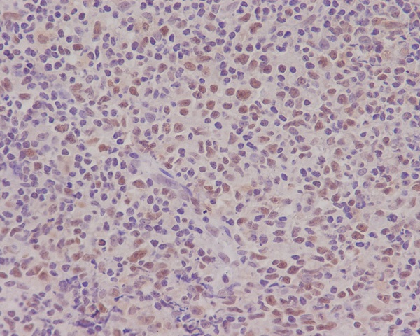 PMS2 Rabbit mAb