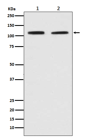 PMS2 Rabbit mAb