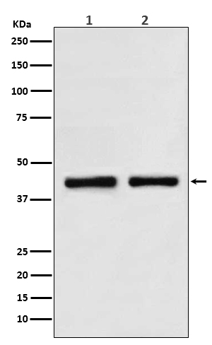 SNF5 Rabbit mAb