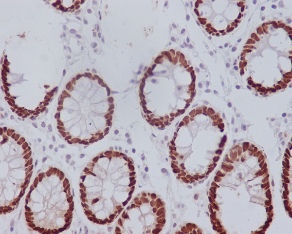 CDX2 Rabbit mAb