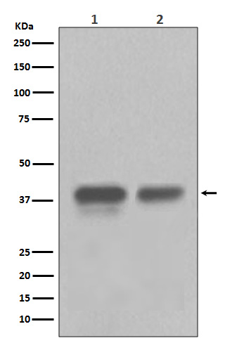 CDX2 Rabbit mAb