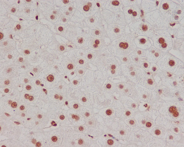 Histone H3 (di methyl K4) Rabbit mAb