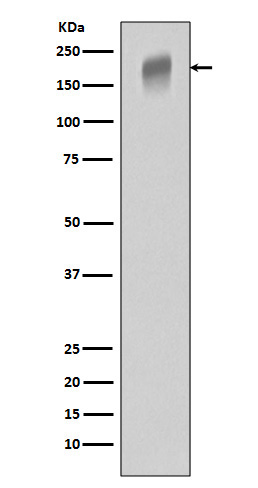 VEGF Receptor 1 Rabbit mAb