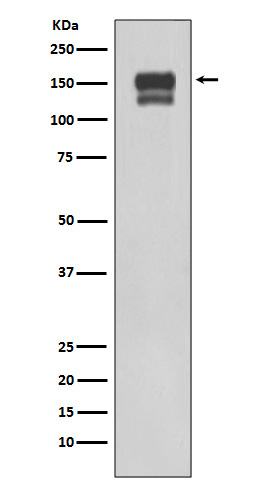 Integrin beta 1 Rabbit mAb