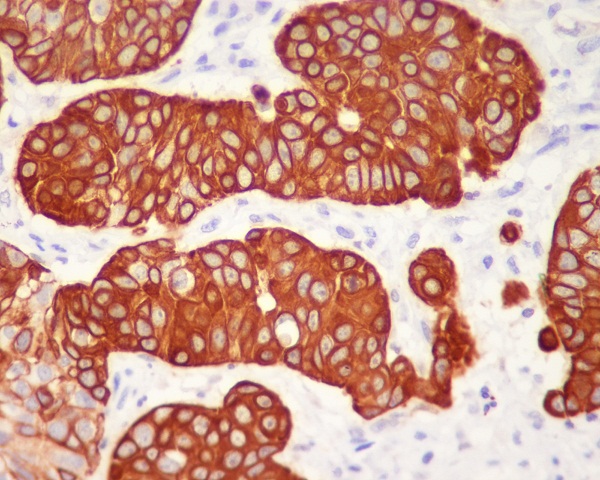 Cytokeratin 5 (C-term) Rabbit mAb