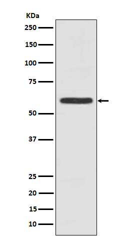 Cytokeratin 5 (C-term) Rabbit mAb