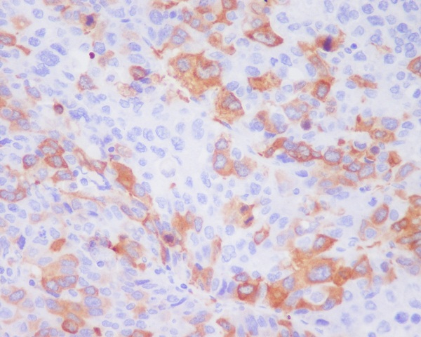 TACC3 Rabbit mAb