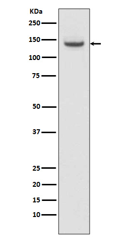 TACC3 Rabbit mAb