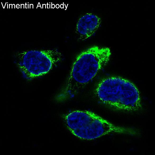 Vimentin Rabbit mAb