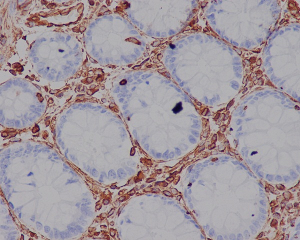 Vimentin Rabbit mAb