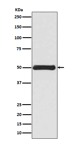 Vimentin Rabbit mAb