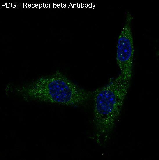 PDGF Receptor beta Rabbit mAb