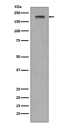 PDGF Receptor beta Rabbit mAb