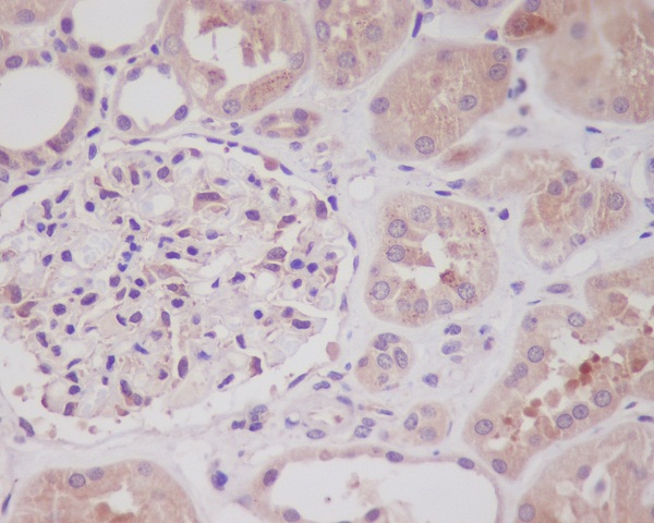 Nrf2 Rabbit mAb