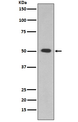 ALDH1A1 Rabbit mAb