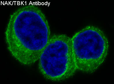 NAK/TBK1 (N-term) Rabbit mAb