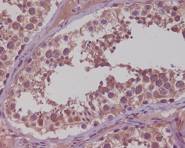 NAK/TBK1 (N-term) Rabbit mAb