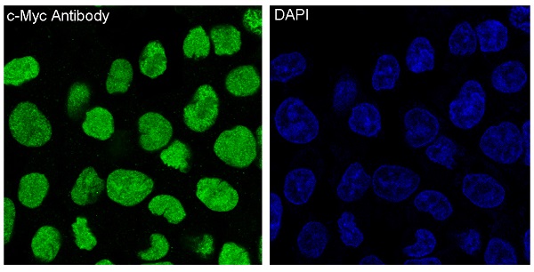 c-Myc Rabbit mAb