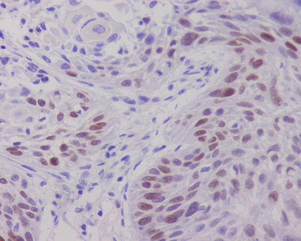 c-Myc Rabbit mAb