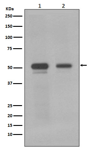 c-Myc Rabbit mAb