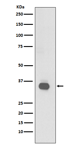 CD20 Rabbit mAb