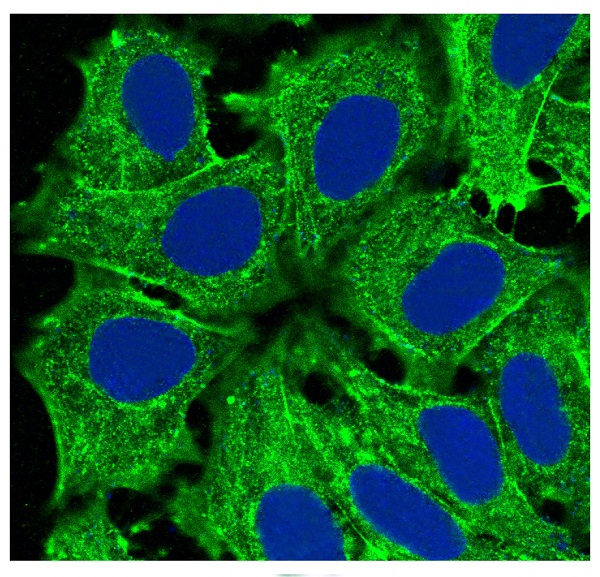 Actin (Alpha-Actin) Rabbit mAb